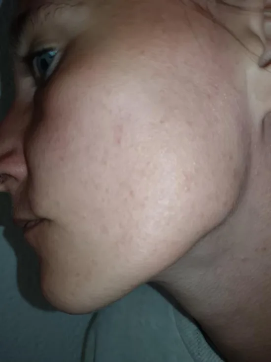 Před použitím - Martina B.